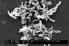 Clostridium difficile baktérium elektronmikroszkópos képe
