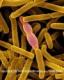Bacillus anthracis