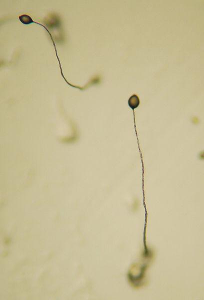 Dictyostelium mucoroides