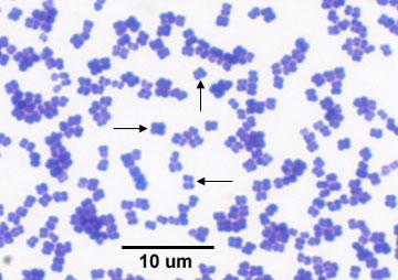 Micrococcus luteus