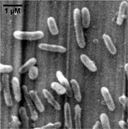 Thiobacillus denitrificans