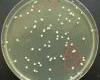 Fejlődő baktériumtelepek agaron