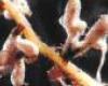 Endomikorrhiza-gombák, vagy VAM-gombák (Glomeromycota)