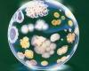 bacterial colonies